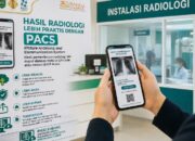 RSUD Subang Digitalisasi Layanan Radiologi, Hasil Rontgen Kini Bisa Diakses Secara Elektronik