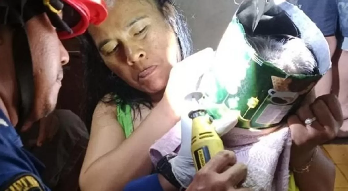 Damkar Ciamis Selamatkan Balita yang Kepalanya Terjebak Kaleng Biskuit
